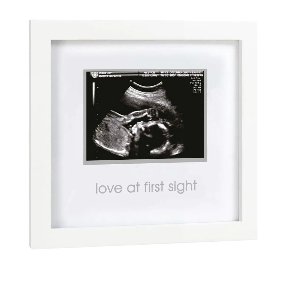 Love At First Sight Sonogram Frame